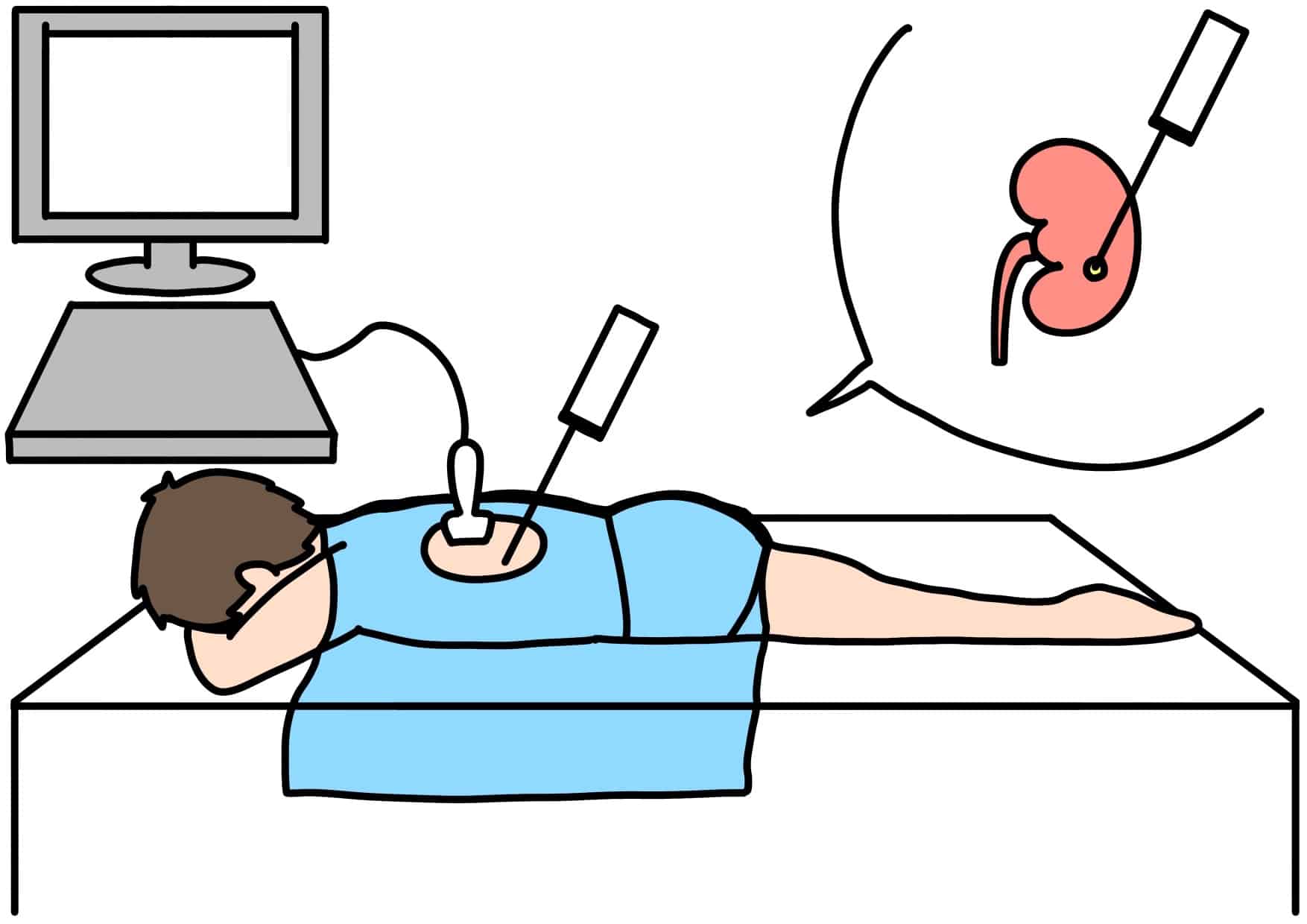 IgＡ腎症疑いで、腎生検の説明を医師から受けて、JALの株を買う【腎臓病日記5】